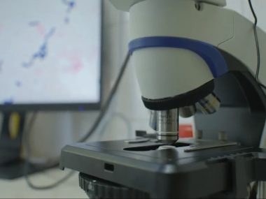 Nowy sprzęt diagnostyczny dla zabrzańskiego szpitala Nowoczesny mikroskop dla zabrzańskiego szpitala