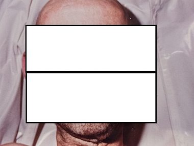 Ten mężczyzna zmarł w katowickim szpitalu. Kim był? Zmarły w katowickim szpitalu mężczyzna
